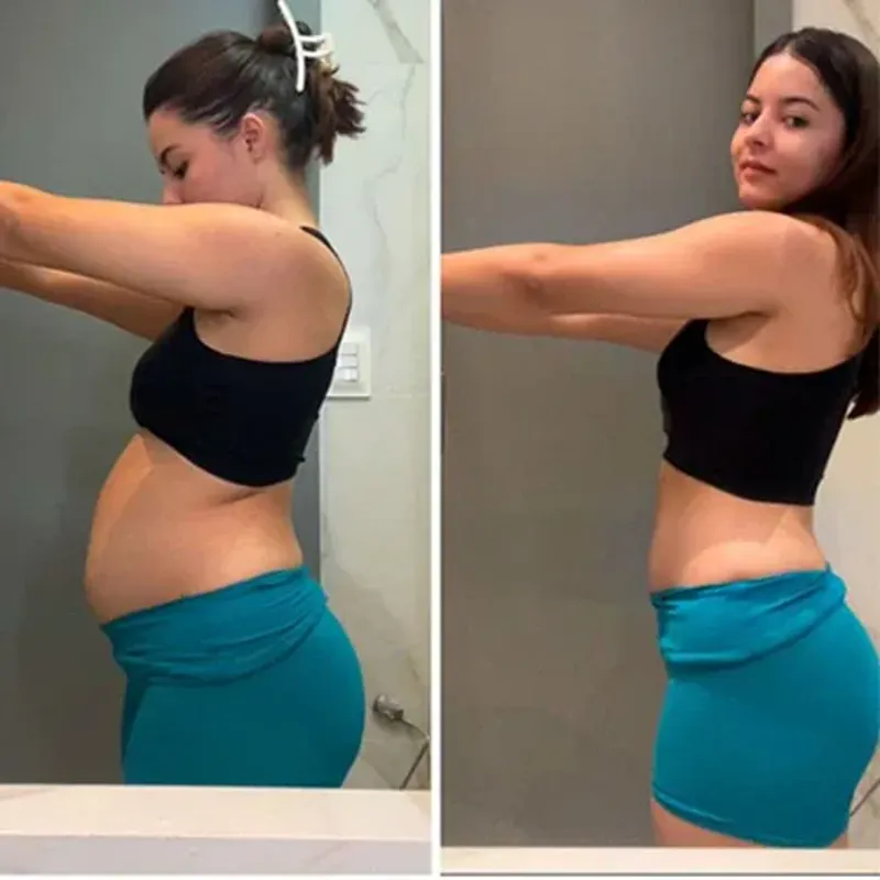 Before and after side profile