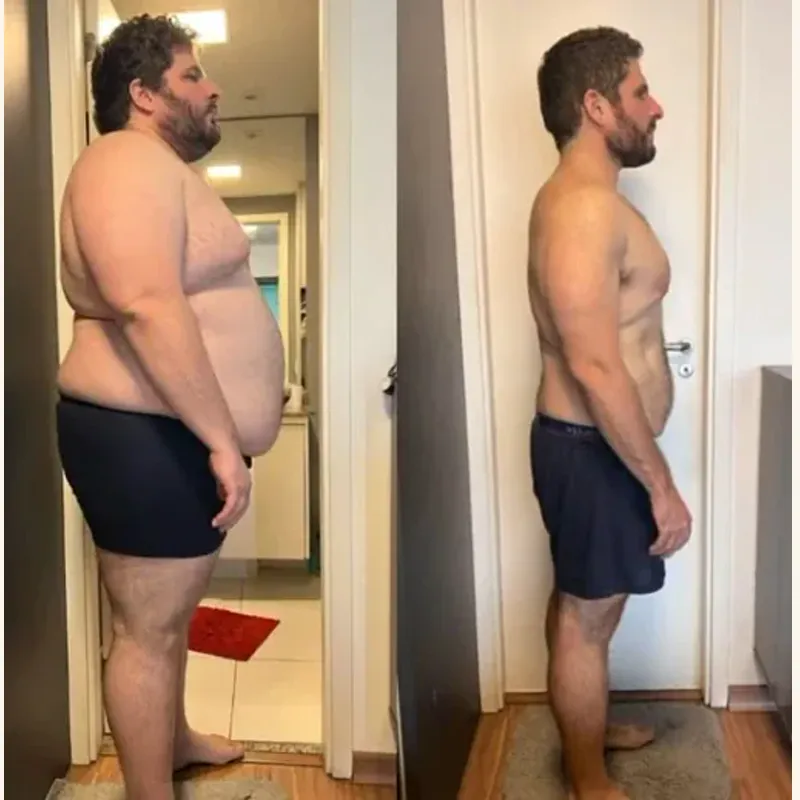Before and after side profile