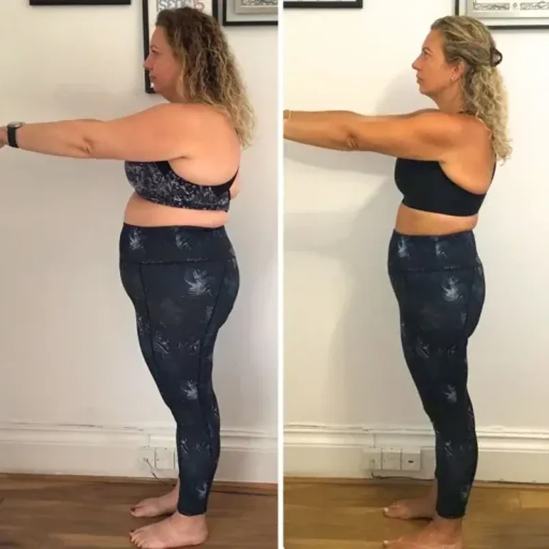 Before and after side view