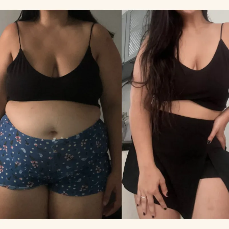 Before and after front view