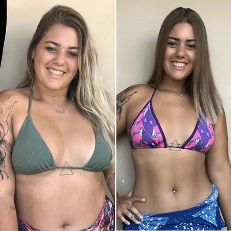 Before and after front view